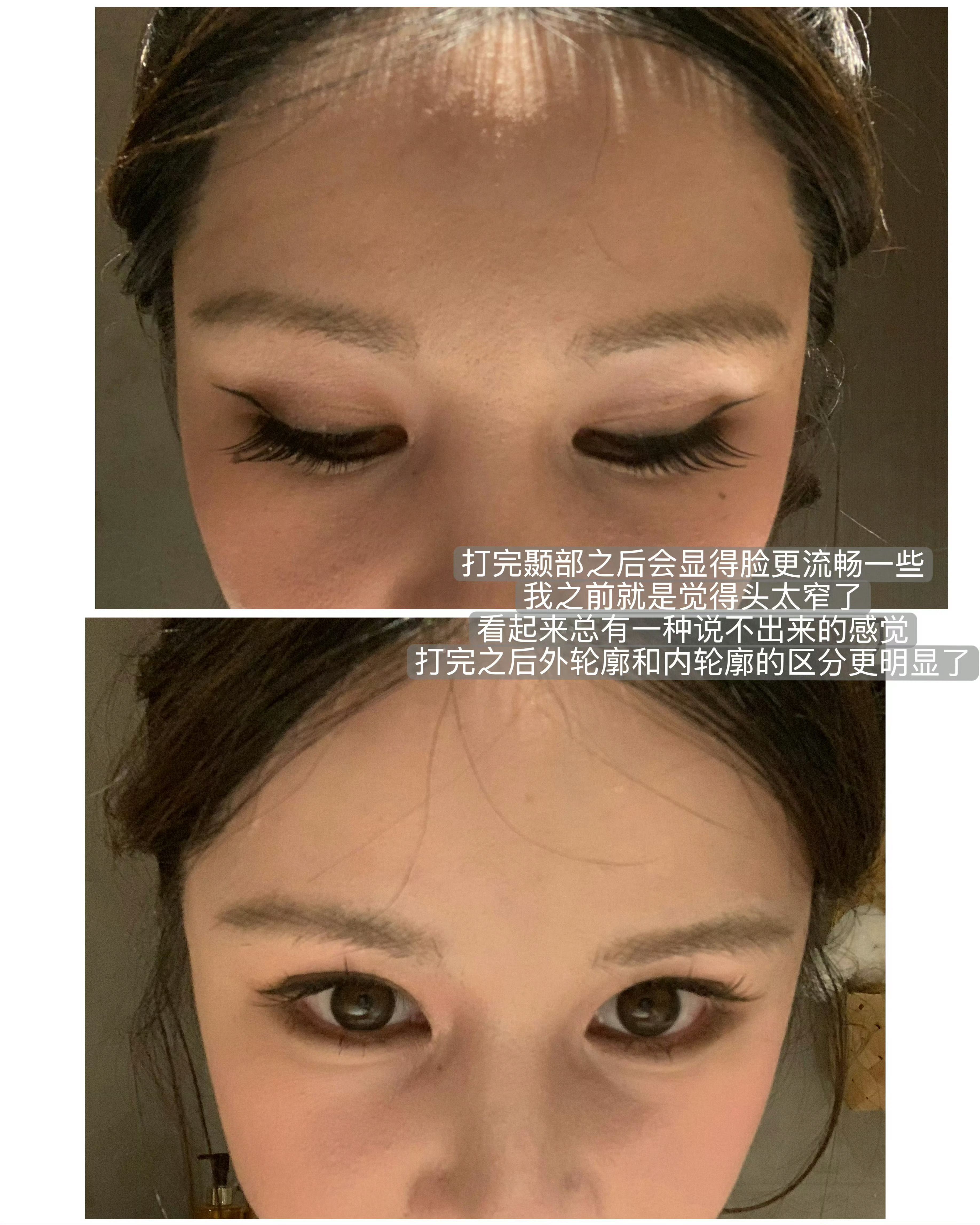 我们8月1号办的「全面部抗衰」线下闭门会，这一次真的不来拍大腿！没有门票哈！过来