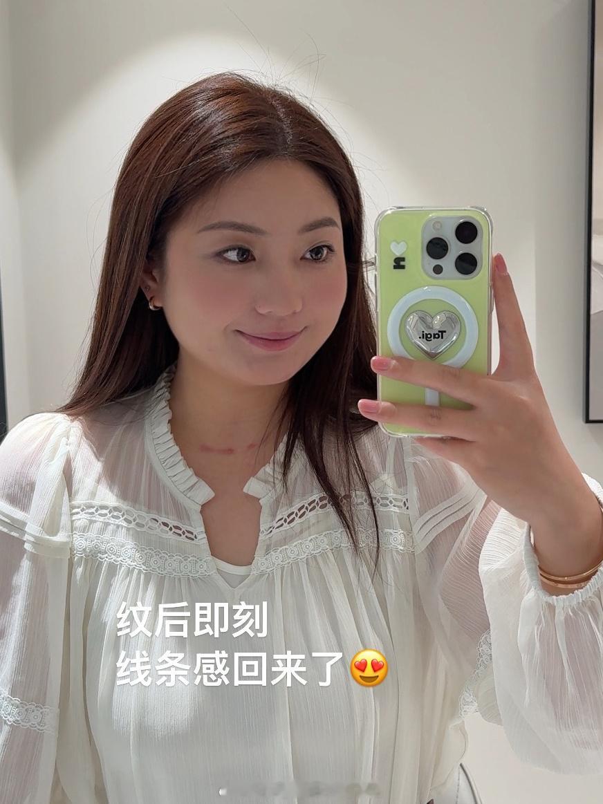 这次回北京去给眉毛补色咯距离上一次纹眉已经半年多了再加上前段时间做手术眉形有点变