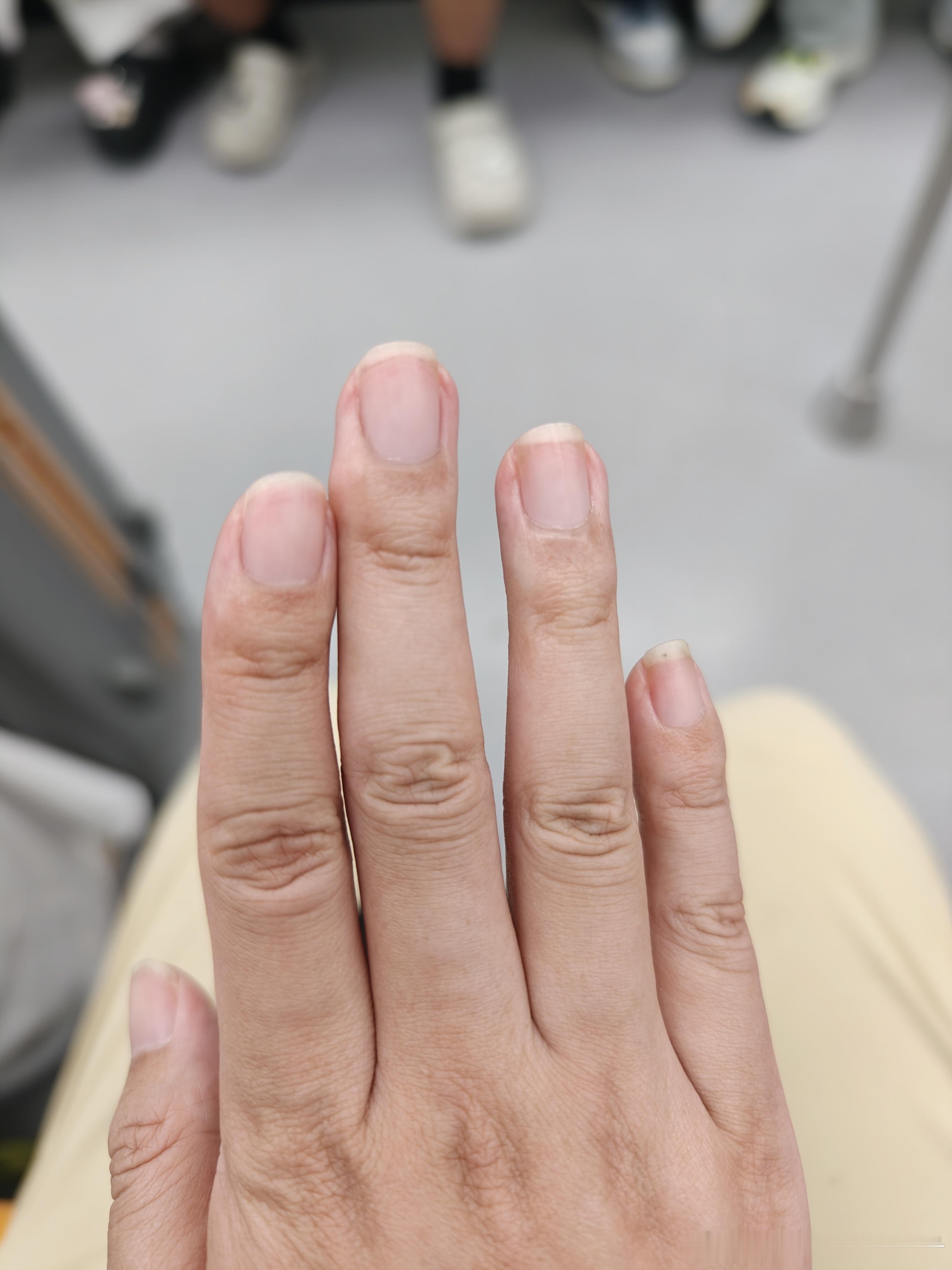 发现中指的握笔茧消失了随着时代额快速进步，以前练的所谓技能有个毛用。小时候毛笔课