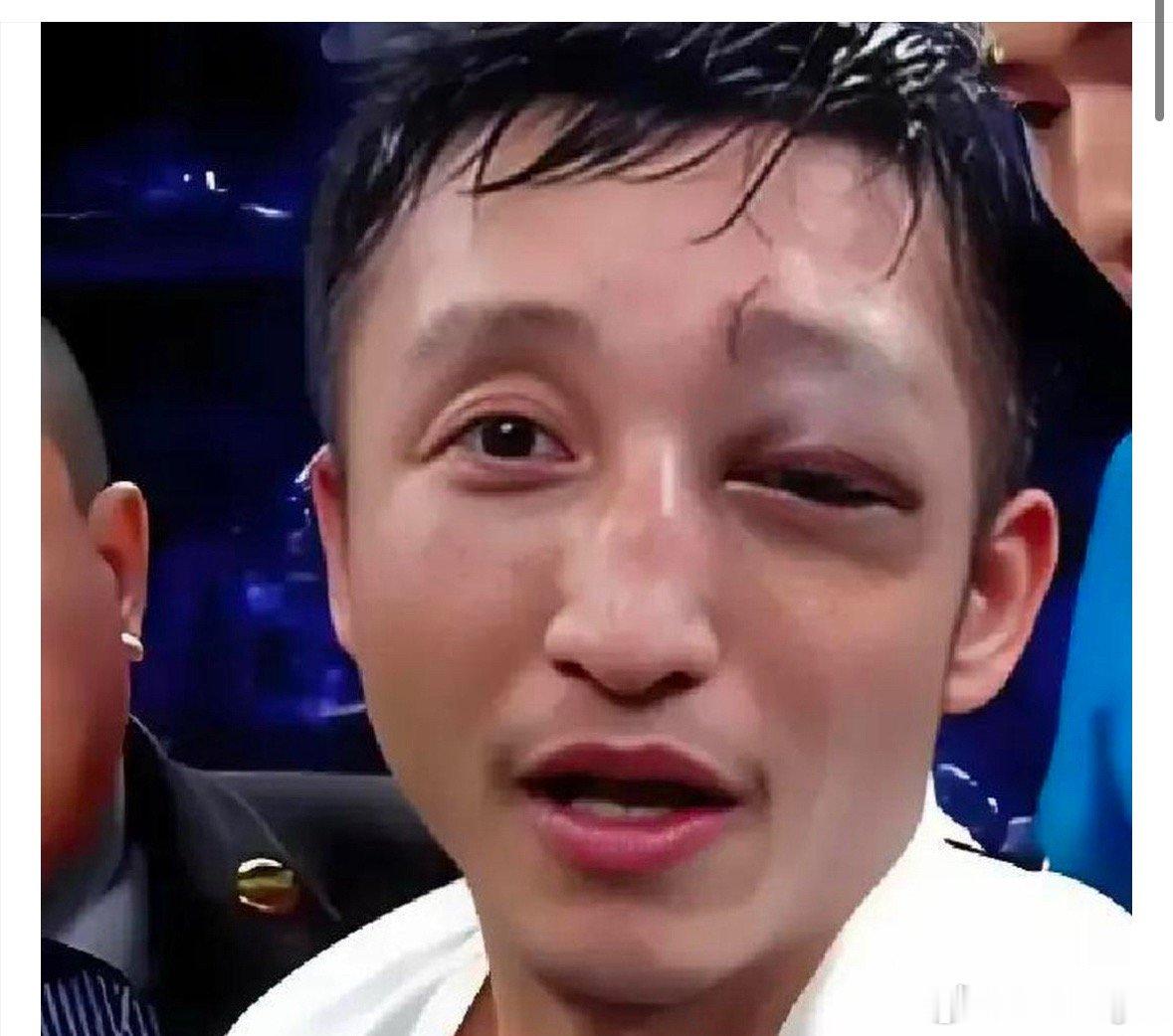 还是不要赚认知之外的钱吧邹市明2亿理财亏损始末