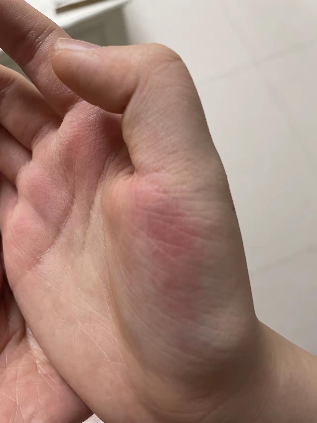 这是个好老师，教育不是万能的，孩子不听话，老师直接打手，想想我们这个年代的人谁没