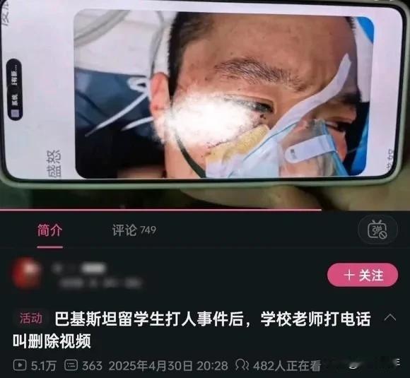 说句扫兴的话！
巴留学生殴打中国学生，半个月了，咋处理的?什么结果?
半个月前，