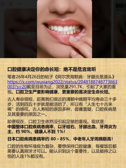 口腔健康决定你的命长短：绝不是危言耸听 