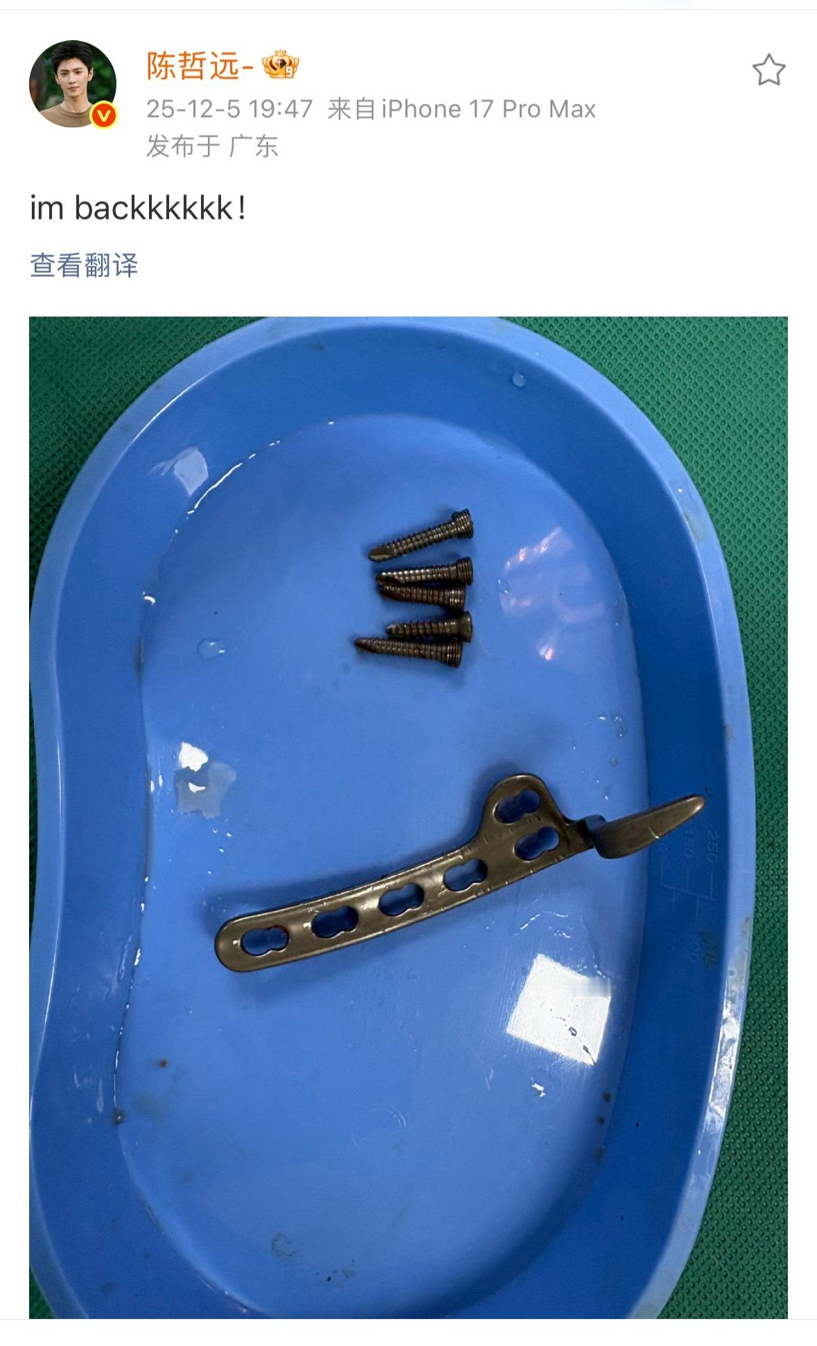 陈哲远回深圳做手术，把钢钉下来了，看的就疼啊，我去。好好休息啊哲远