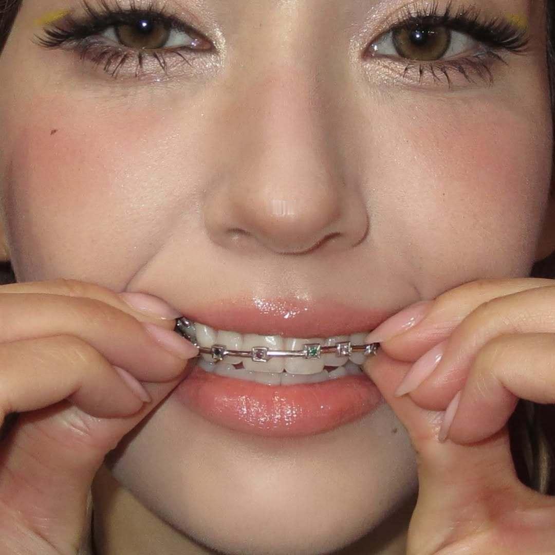 somi ins更新 