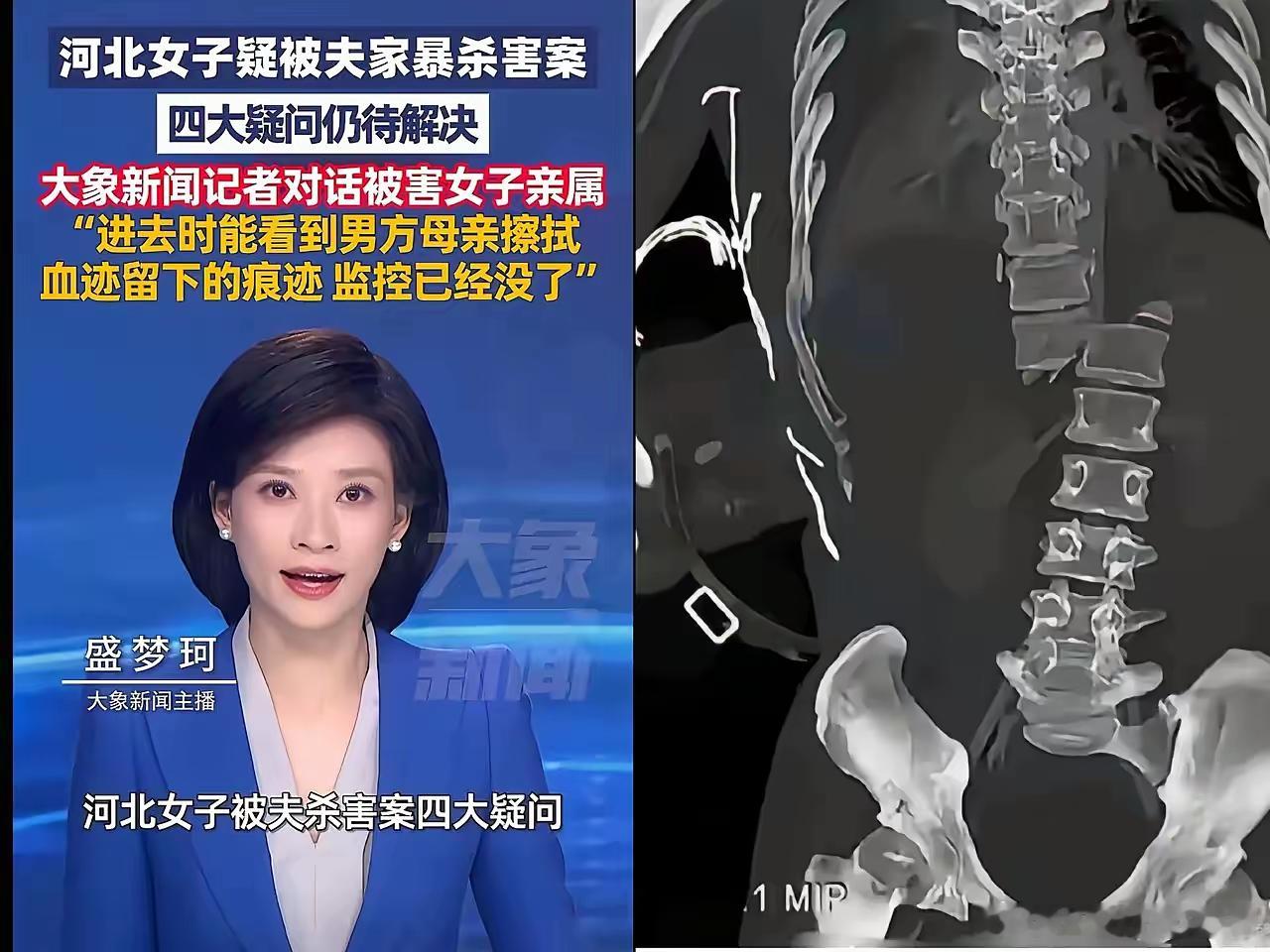 以前听说有个词叫“往死里打”。不太理解。直到看了这张照片。她不是不想逃，可全身多