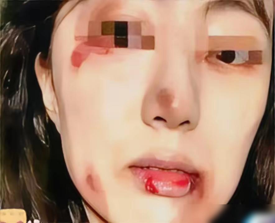 凌晨三点的出租屋，刚剖腹产一周的小莉扶着墙从厕所出来，伤口还在渗血，腿软得打颤。