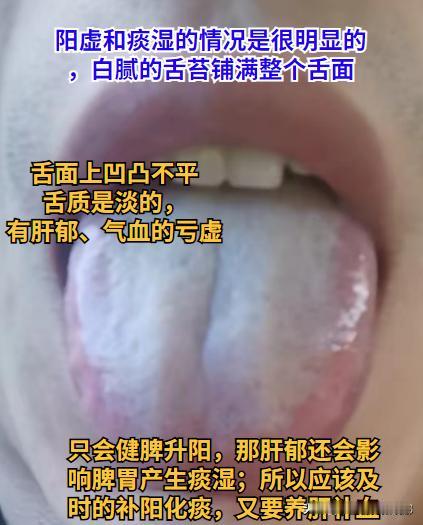 如果不是忽略了这一点，用2周的桂附地黄就真的差不多了，可惜！

阳虚和痰湿的情况