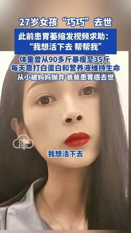 2025年12月17日凌晨，广东27岁女孩“巧巧”因胃萎缩离世，体重仅剩35斤。