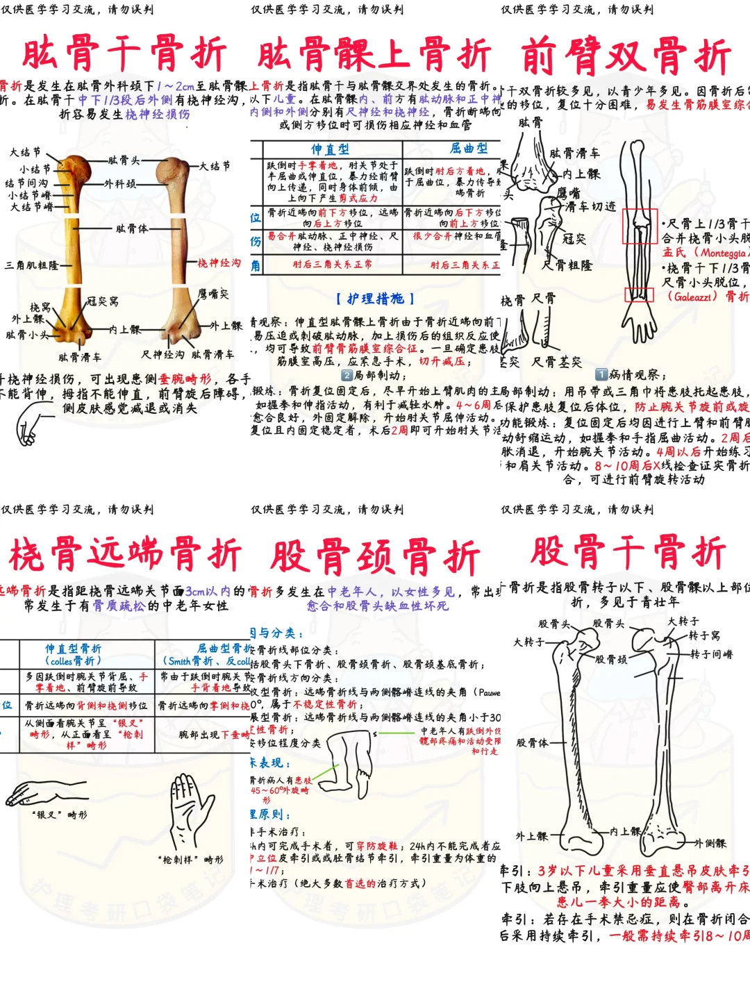 📒医学生笔记｜一文搞定四肢常见6种骨折分类