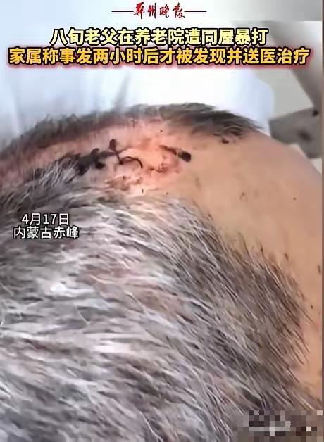 内蒙古赤峰，女子将丈夫送到养老院，几天后接丈夫，只见丈夫裤子直接裂开到裤裆，上衣