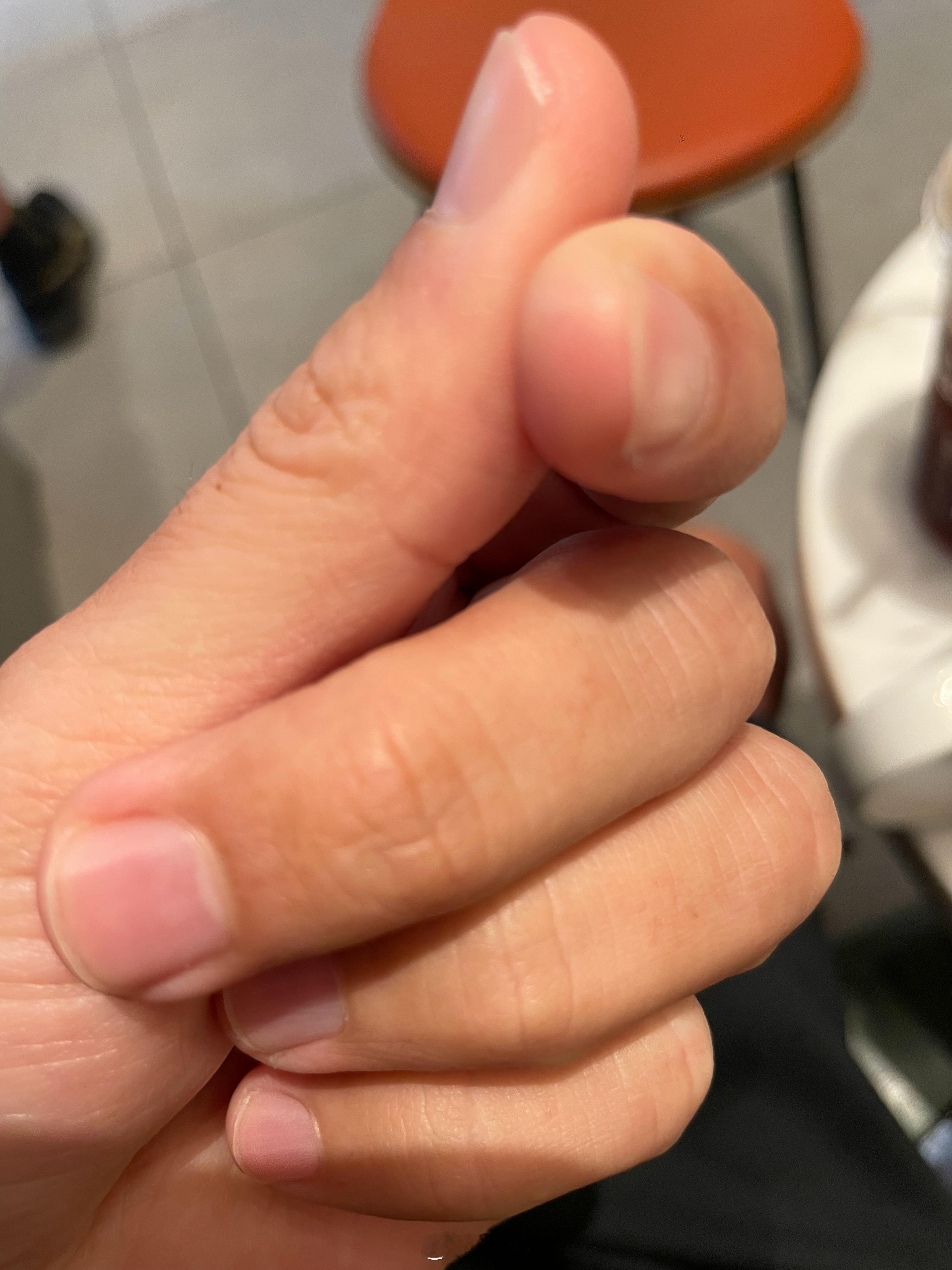 指甲不要剪太底，最好留一点白，不然很容易流血，经验之谈！ 