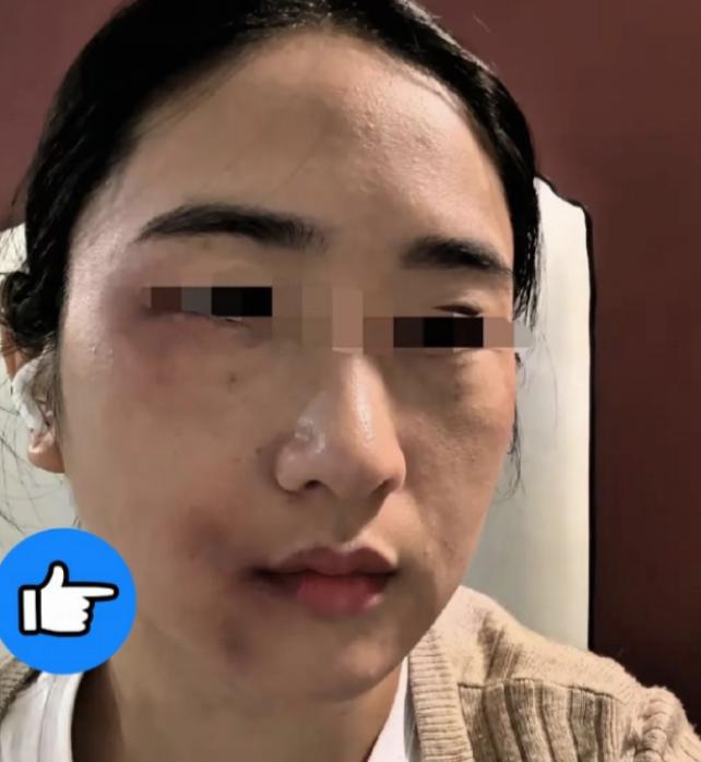 女子遭丈夫殴打后，弟弟得知情况，拿起家中的一根钢管赶到姐姐家。丈夫开门后，弟弟没