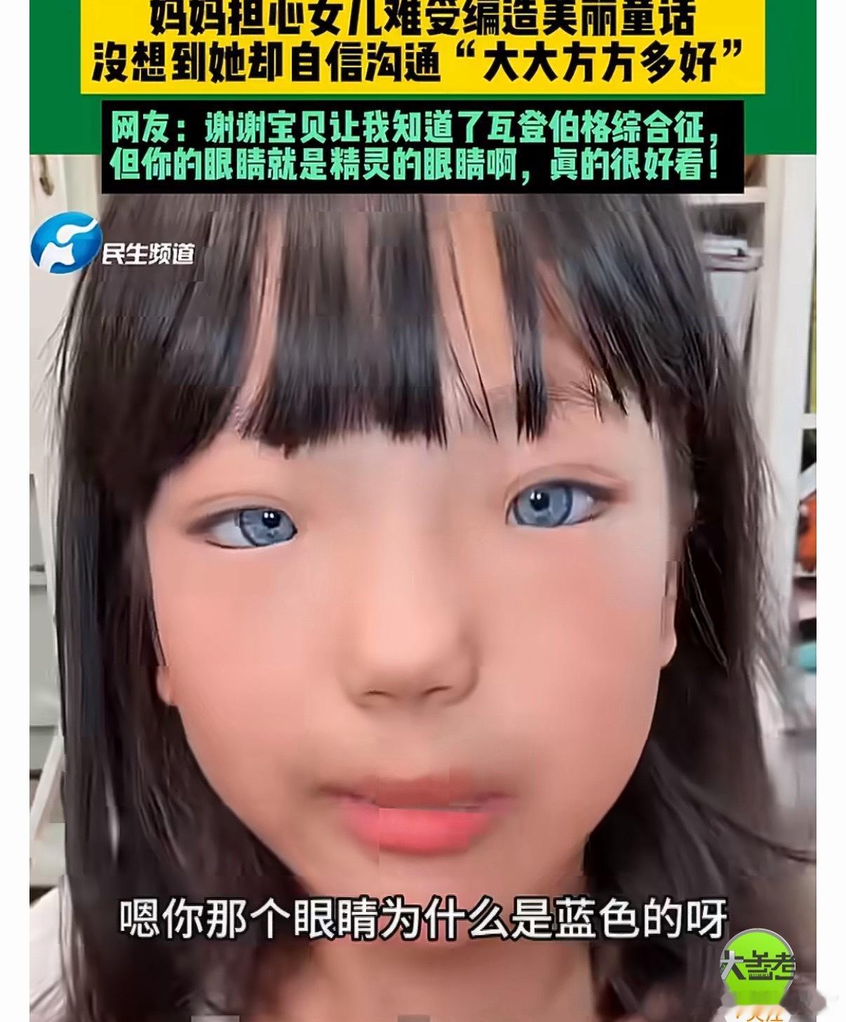 小女孩患罕见病眼睛天生蓝色父母用爱托举，孩子就会自信大方，教会孩子接受大大方方接