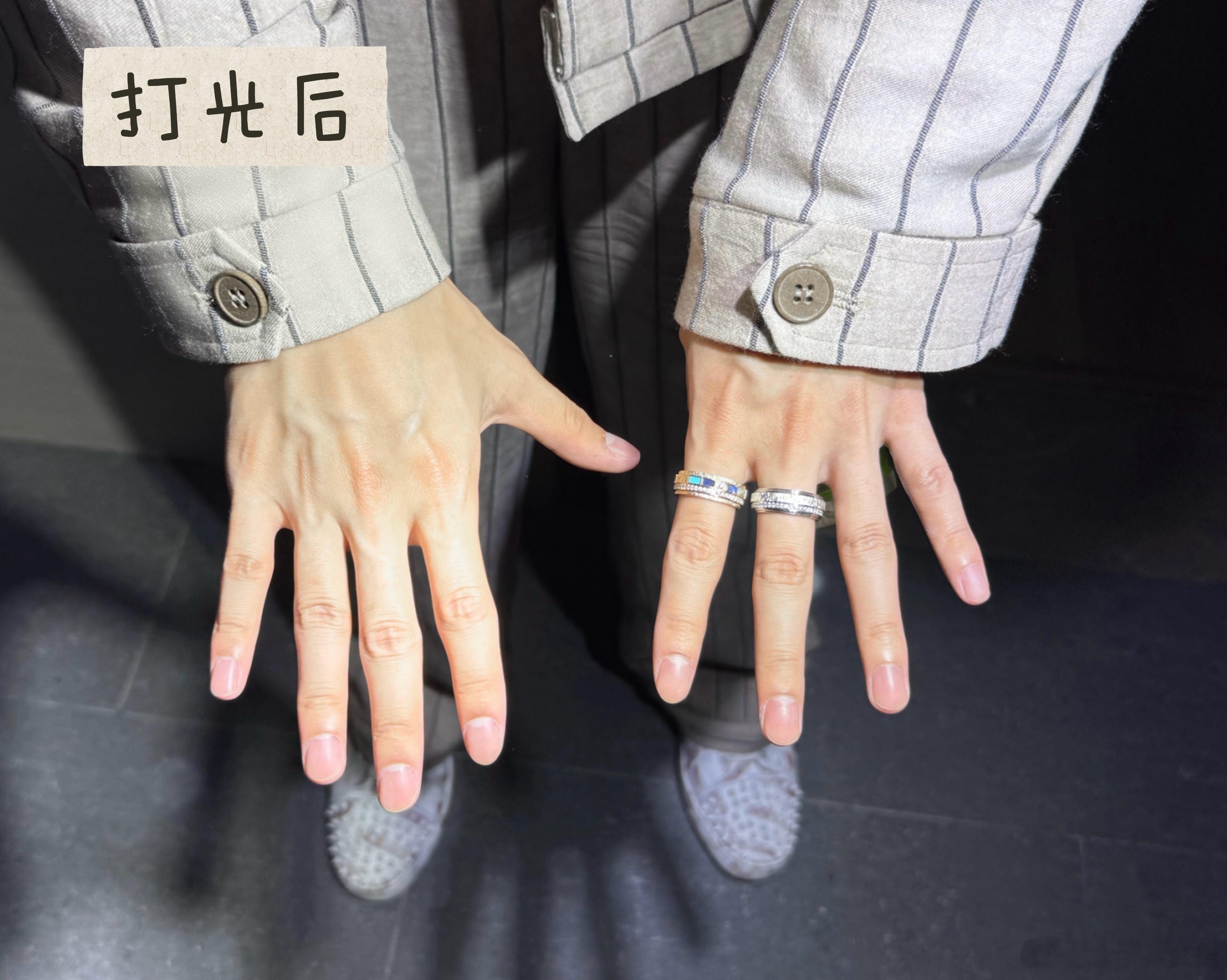 就是光线问题！！我们白着呢