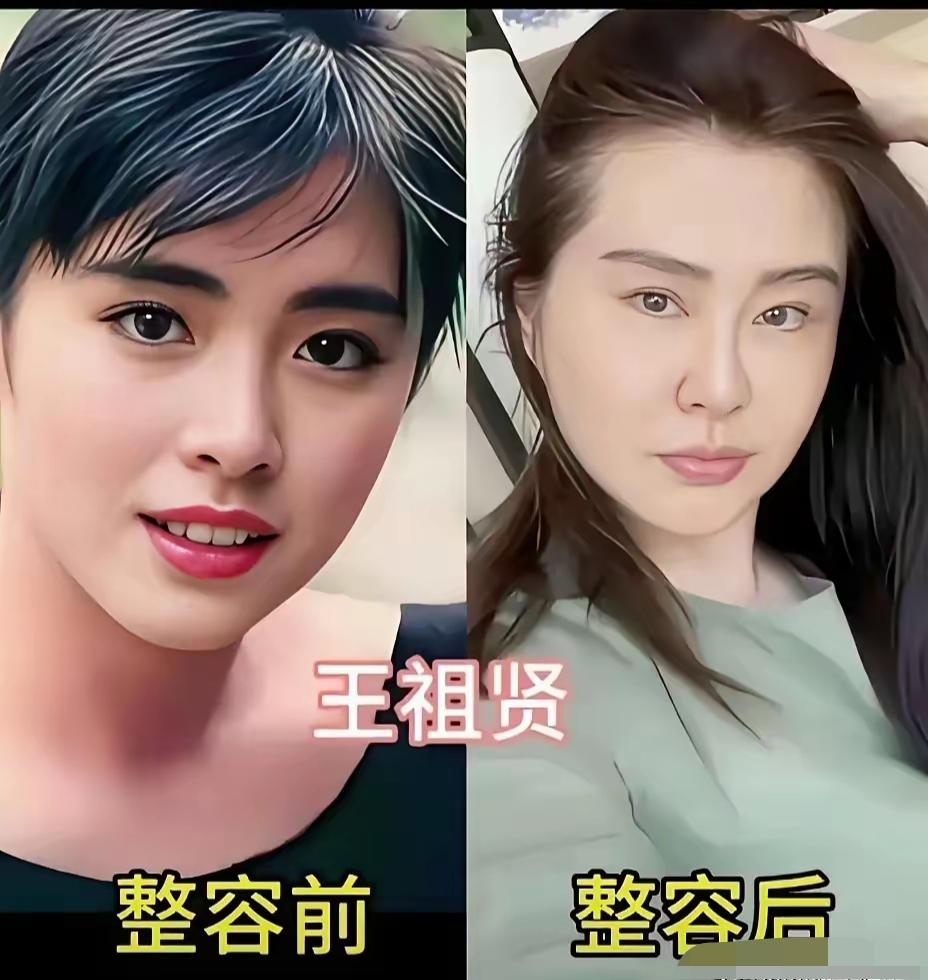 爱美本是人之常情，谁都希望自己容貌更出众，但整容这件事也要把握分寸，就像做菜放盐