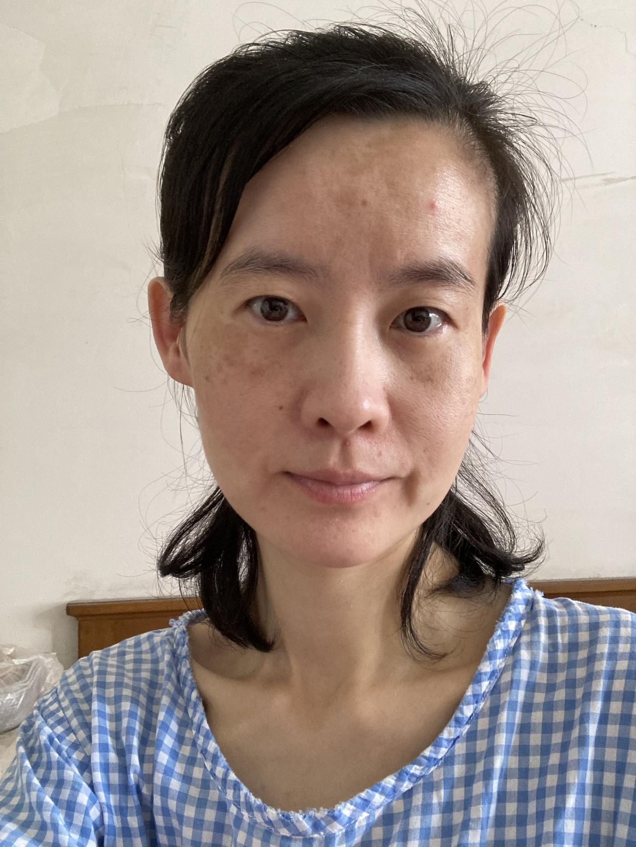 2016年肺结核复发，2018年停药，别人以为，只是吃点药，会有多严重？可是那药