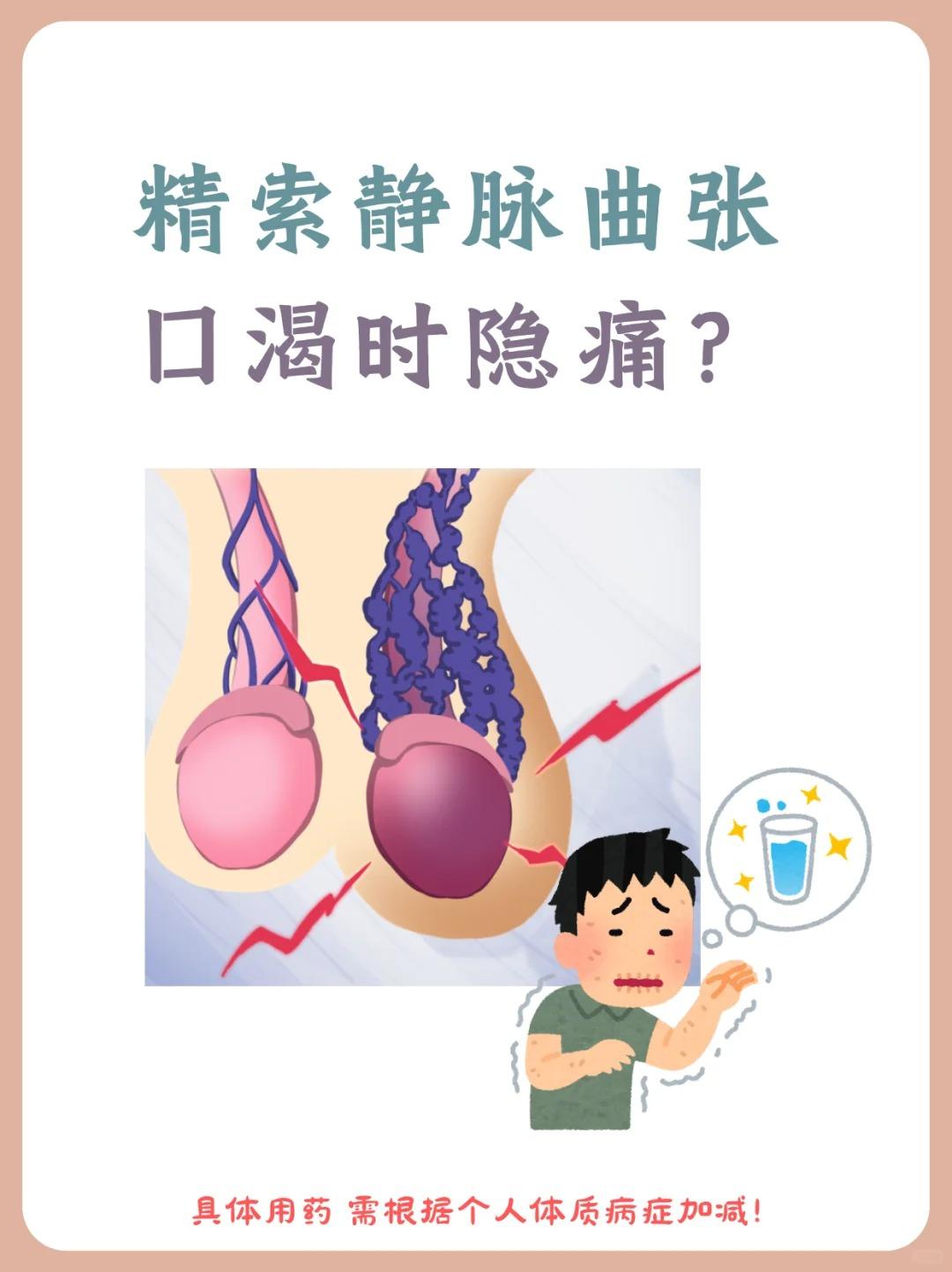 【精索静脉曲张，口渴时隐痛，是怎么回事？】






精索静脉曲张在中医属“筋