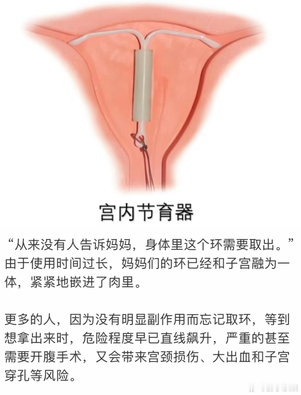 戳中难言之隐！老年女性因羞耻默默忍痛，剧集告诉大家：这不是丢人事，要勇敢面对～ 