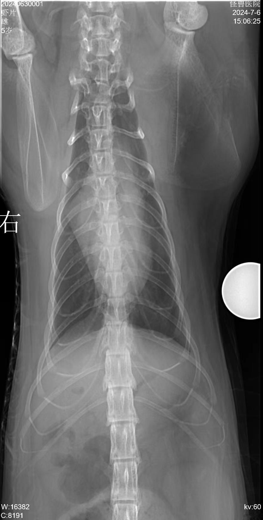 【怪兽病例】修一颗❤️，猫腹膜心包疝，肝叶进入心包，修补完成，期待康复。今日已出