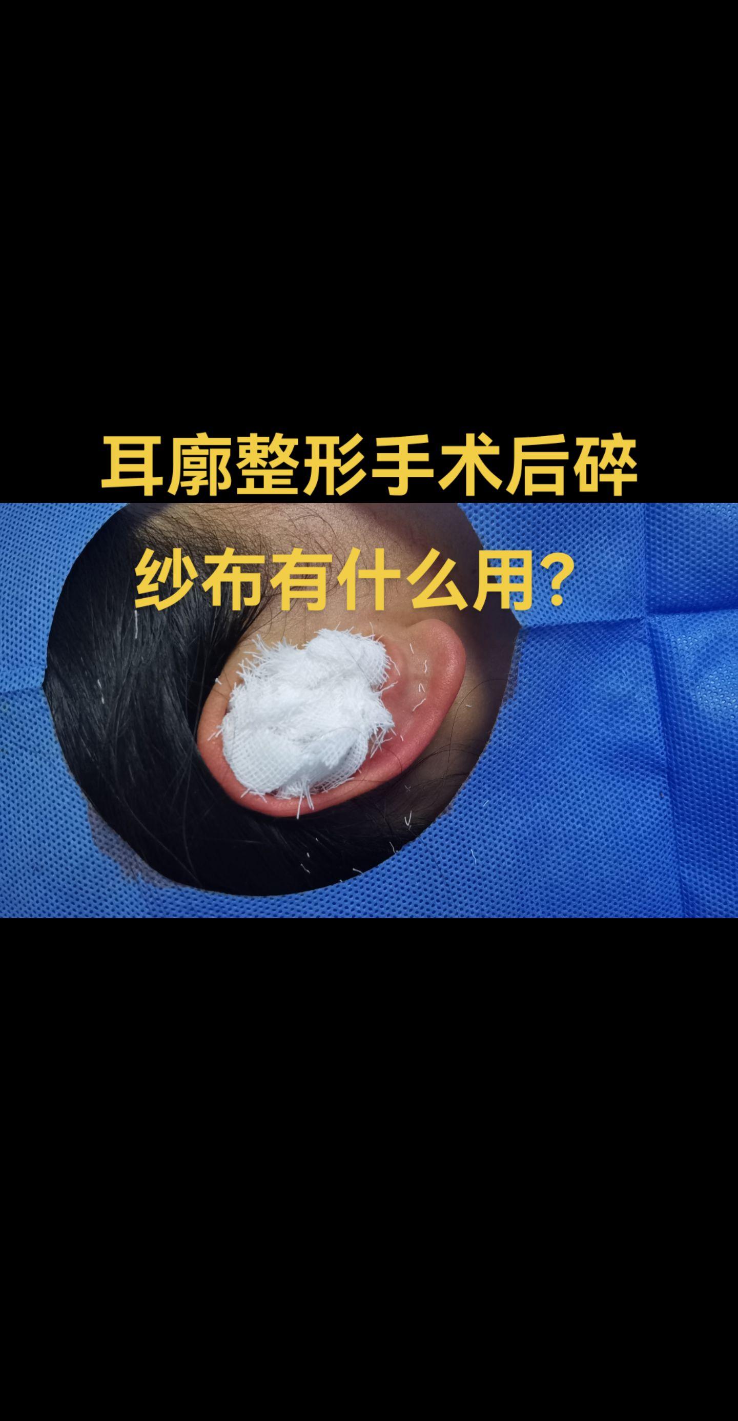 耳廓手术。有人知道耳廓手术后用碎纱布起什么作用？