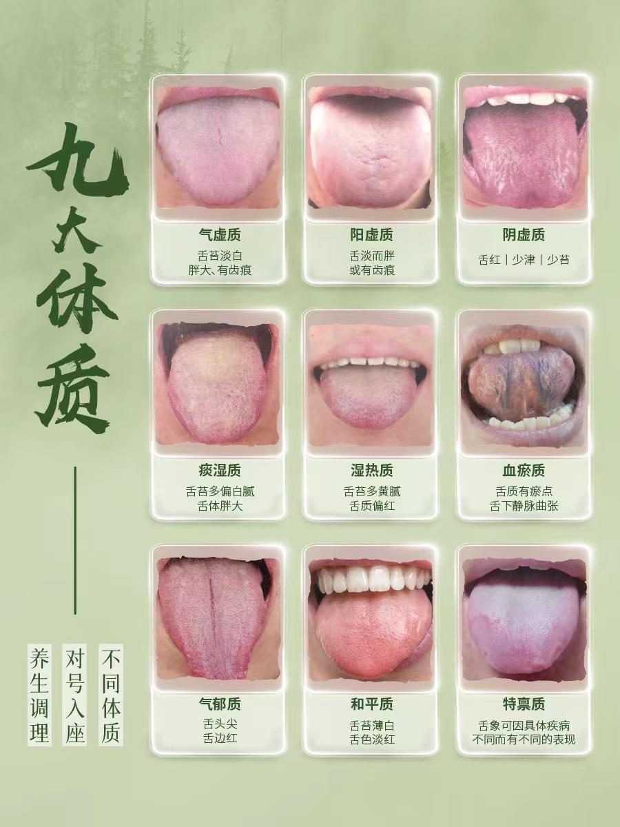 中医九大体质对照调理，别在傻傻分不清了！
最近发现很多朋友，身体一不好，就吃各种