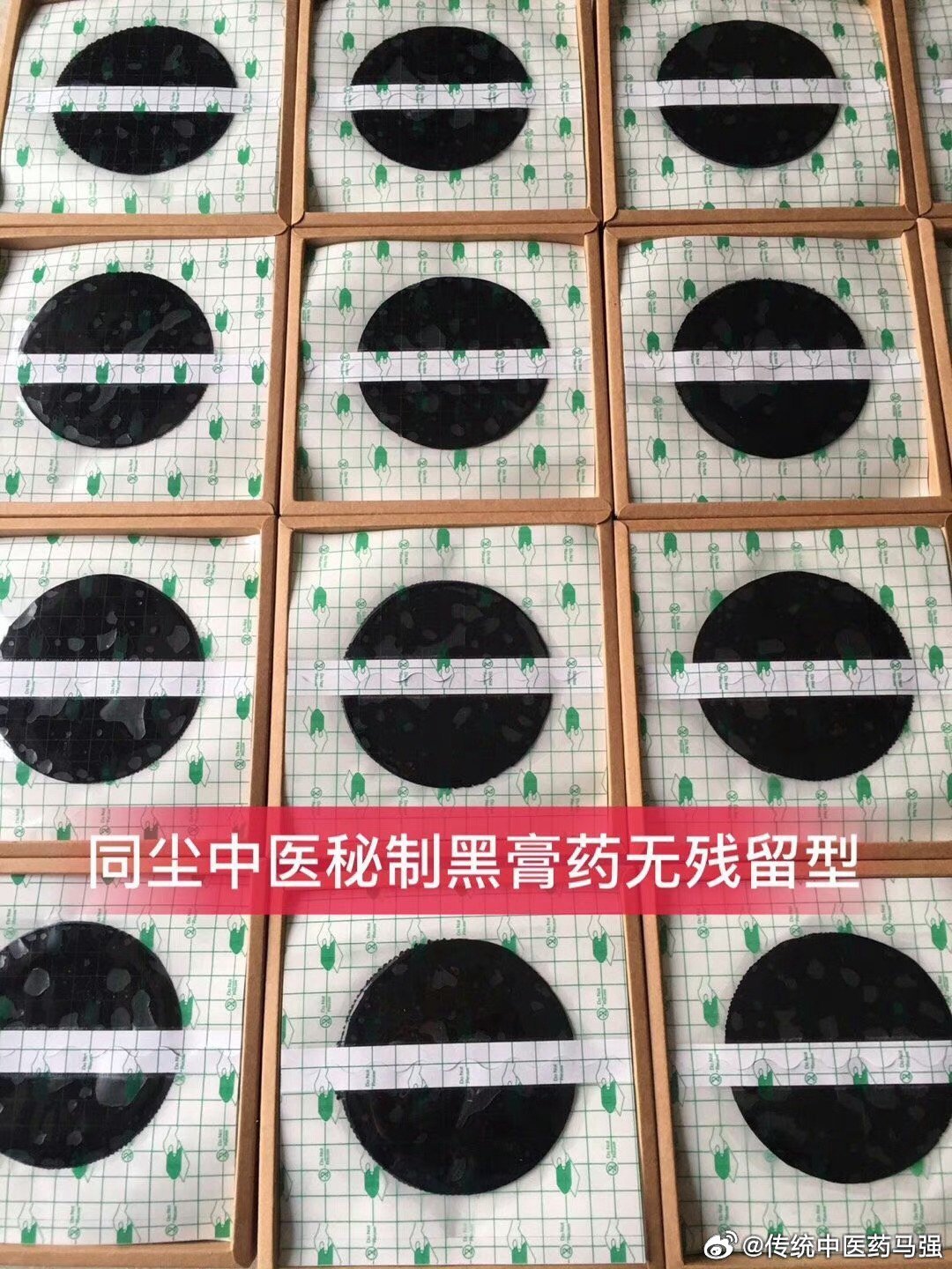 导致膝关节疼痛的三大根源膝盖是人体最大、最复杂的承重轴承，它的疼痛绝非偶然。1.