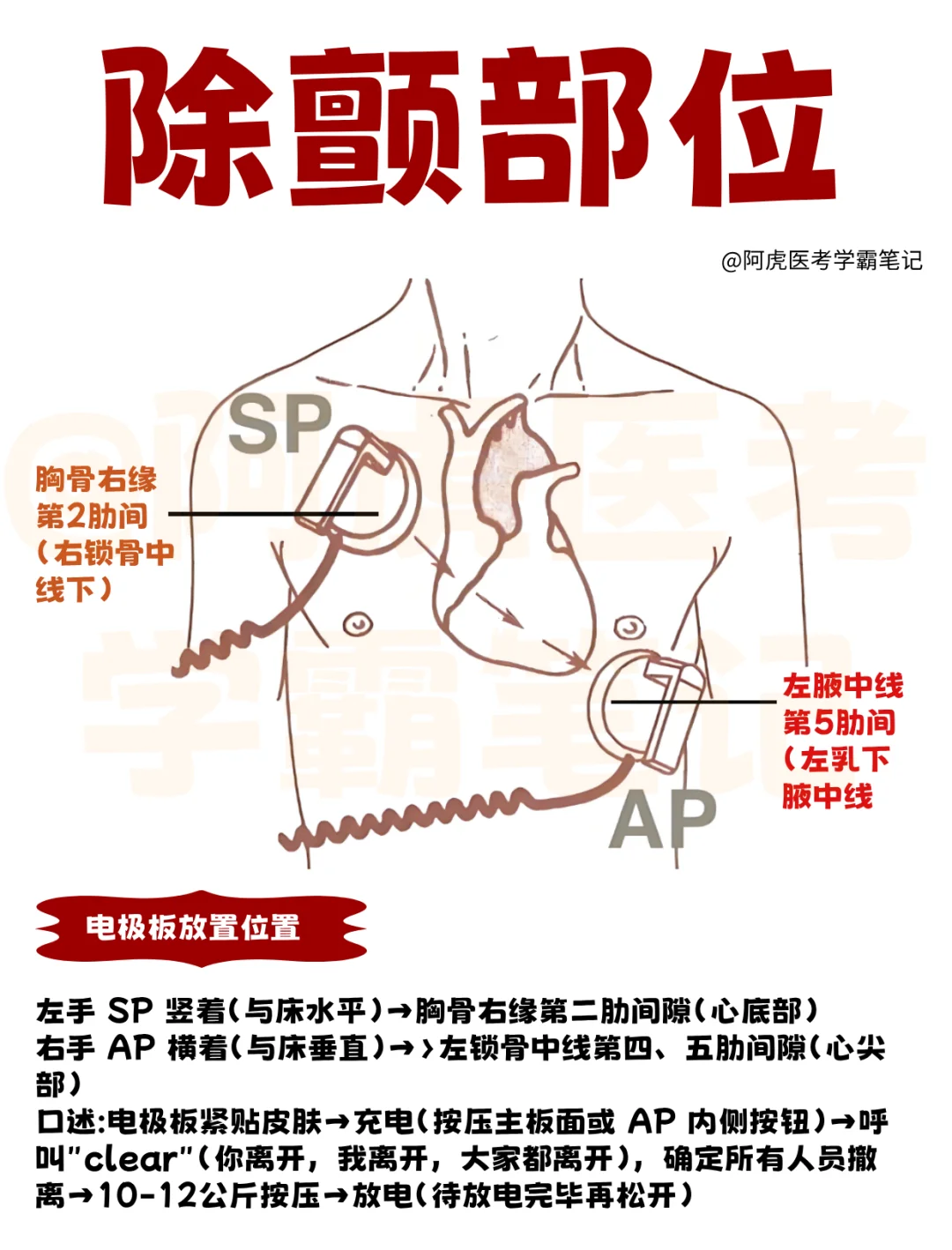 医学生笔记📒：除颤部位👆