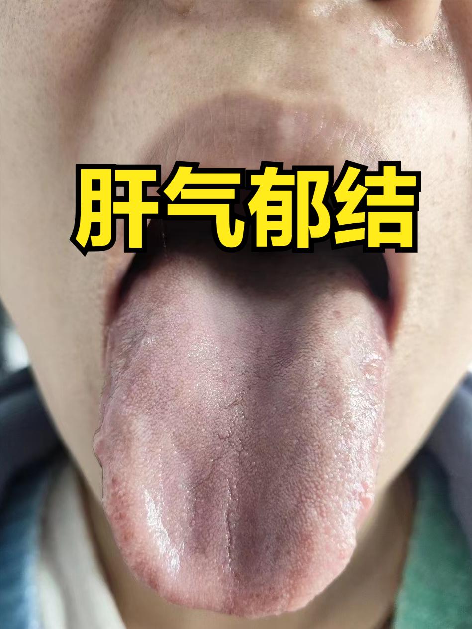 男人行不行？就看肝血能不能顺利抵达宗筋

肝经循行经过宗筋，宗筋能不能正常起来，