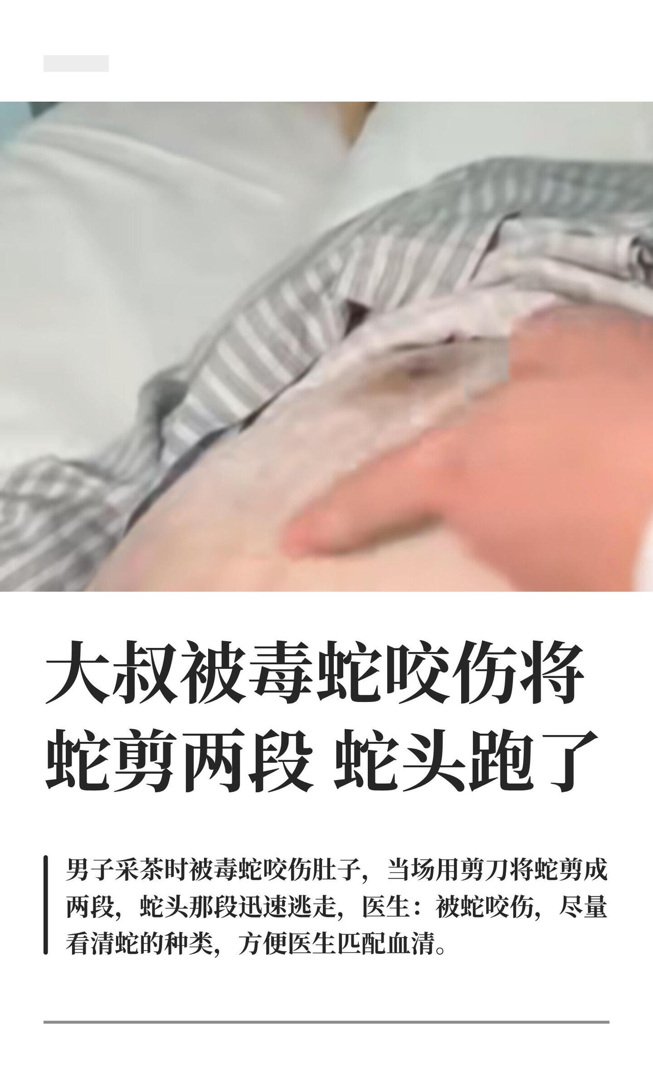 广东惠州60岁的佑叔采茶，被竹叶青咬了肚子。他当场拿剪刀把蛇剪成两段，蛇头那段还