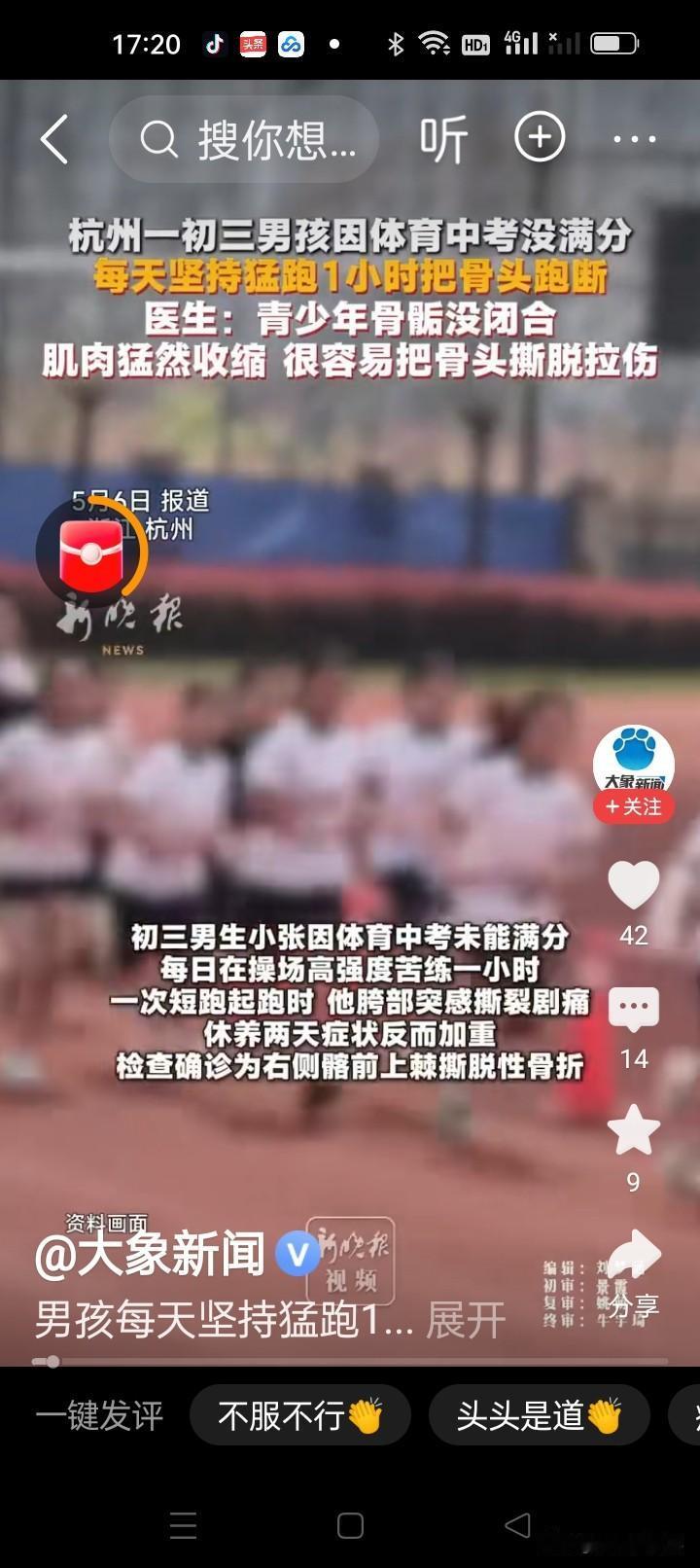 男孩每日高强度跑步一小时，把骨头跑断！
 
近日，浙江杭州一名初三男生为备战体育