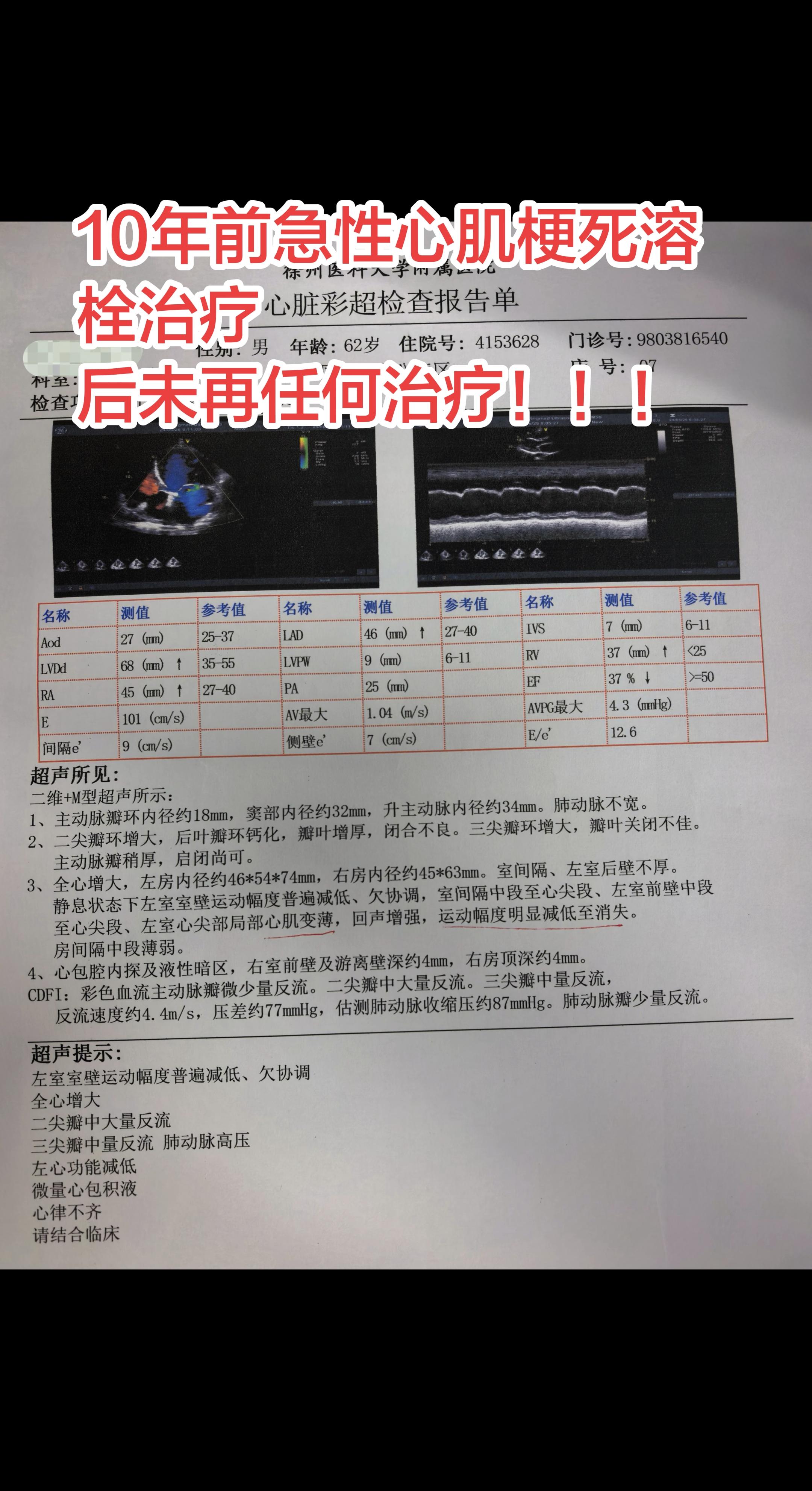 62岁，10年前 治疗，后未再行任何治疗，心脏彩超显示心脏扩大，二尖瓣...