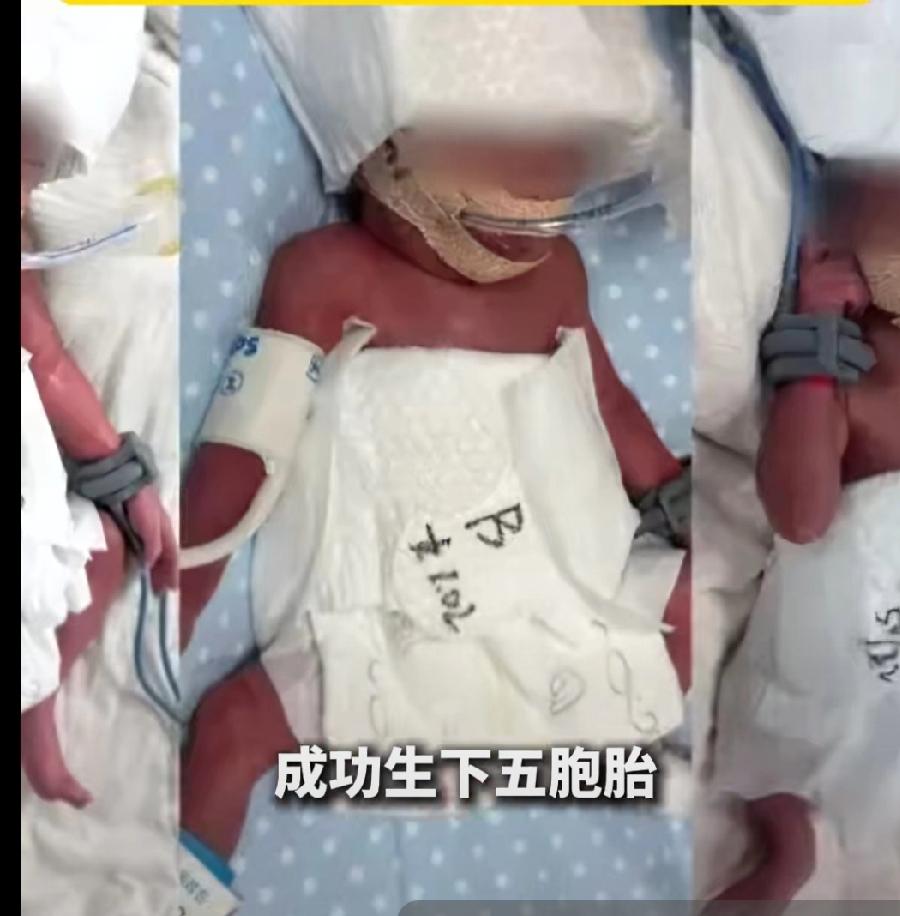 成生命的极致奇迹，新疆24岁女子成功生下五胞胎，出生概率仅为6000万分之一，2