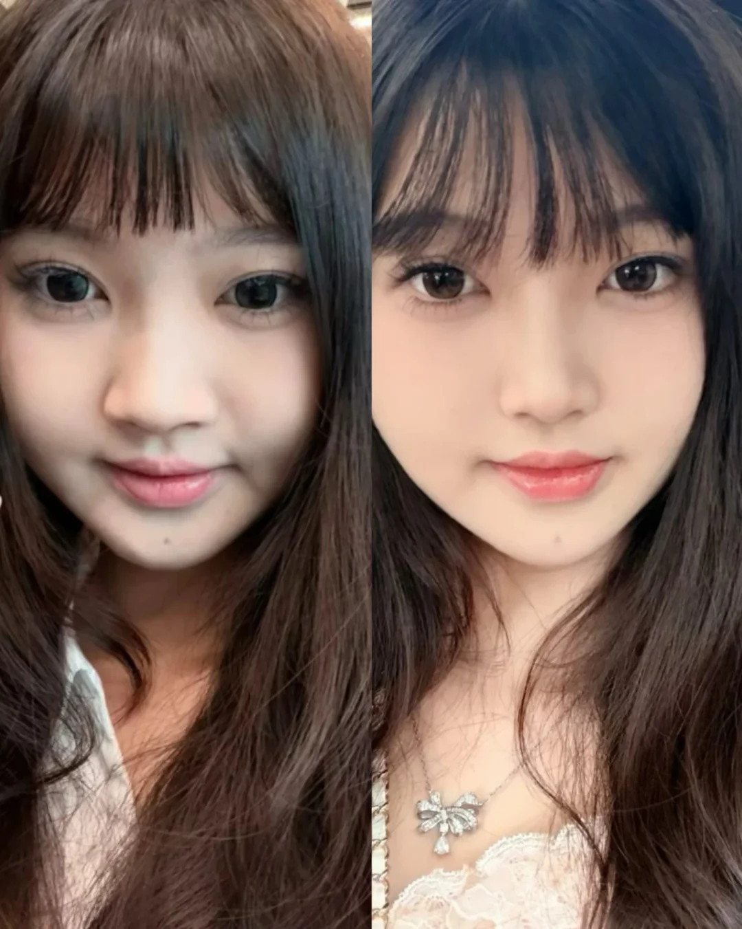 跟风缩了👃，适合我吗