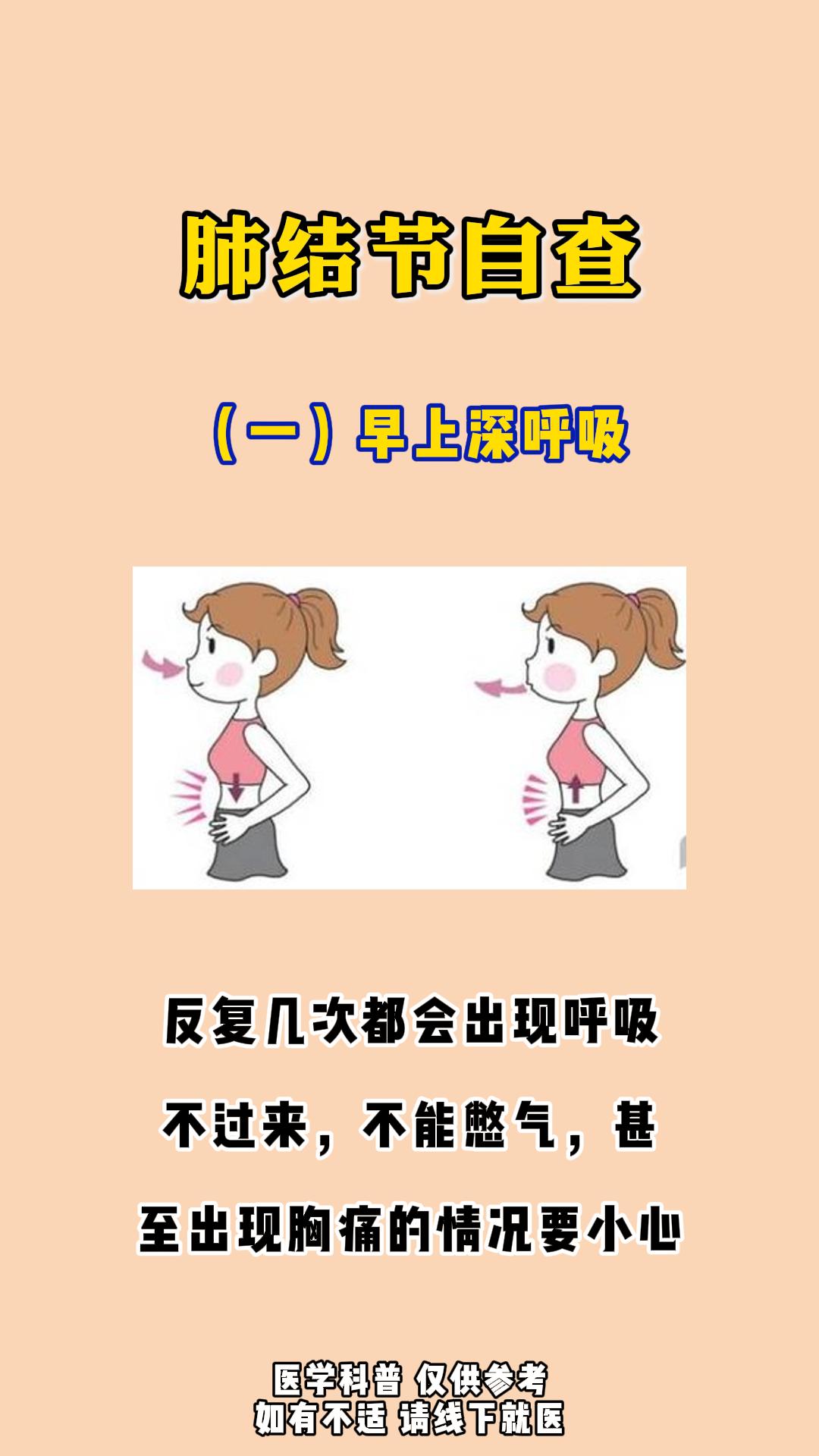 肺结节自查 。