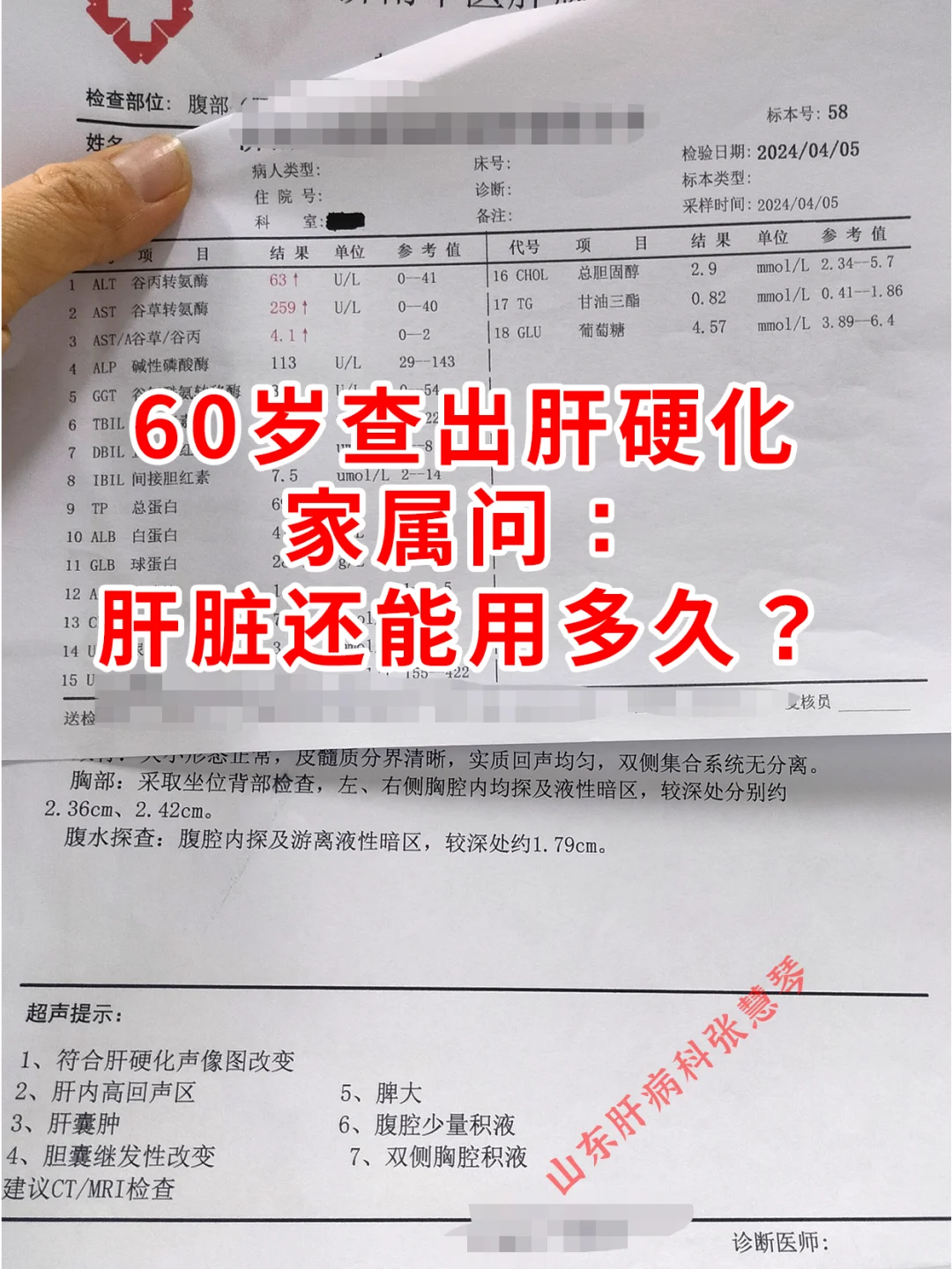 60岁老人查出肝硬化，家属问了这样一个问题