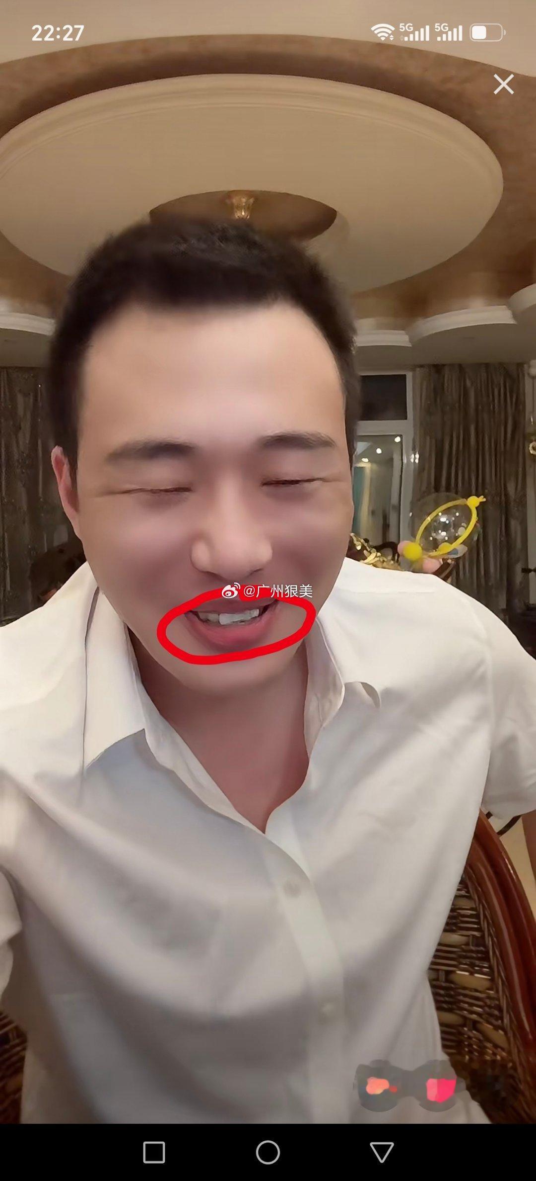 苞米小根这牙怎么了网红小根苞米恋爱