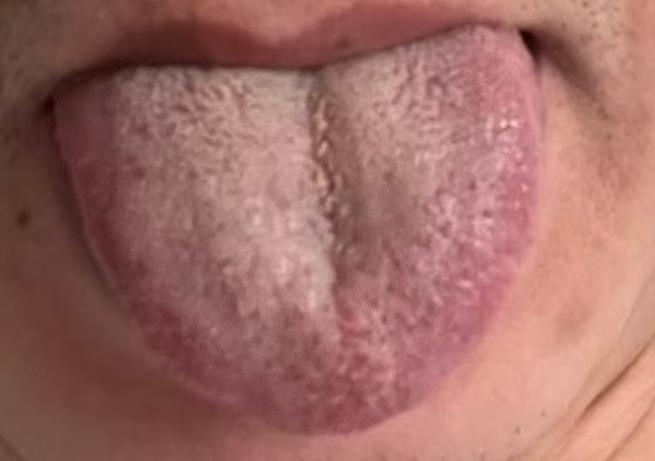 中年精力大不如前？或是血瘀堵塞了经络






有相当一部分朋友到了中年就遇见