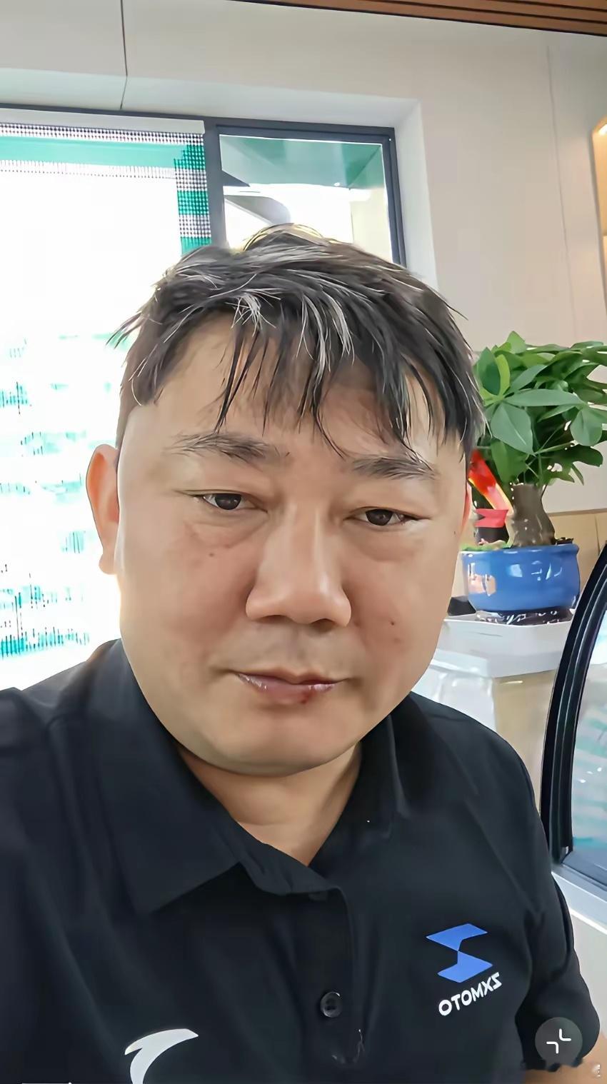 一度怀疑发型师是不是跟张雪有仇？人家都说发型刚做出来不好看的，长长就好看了。可是