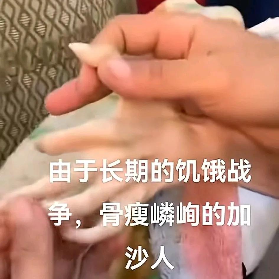 由于长期战争，饱受饥饿瘦骨嶙峋的加沙人，这就是文明世界的文明人的所为
孩子们不应