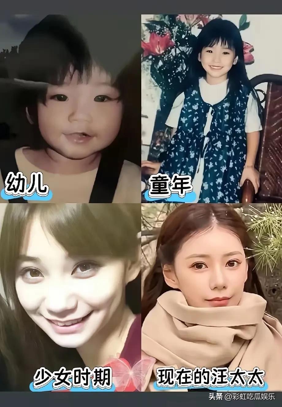 马筱梅鼻子和小时候不一样，小时候发的鼻子没有山根和鼻梁，我觉得她可能是做了鼻子，