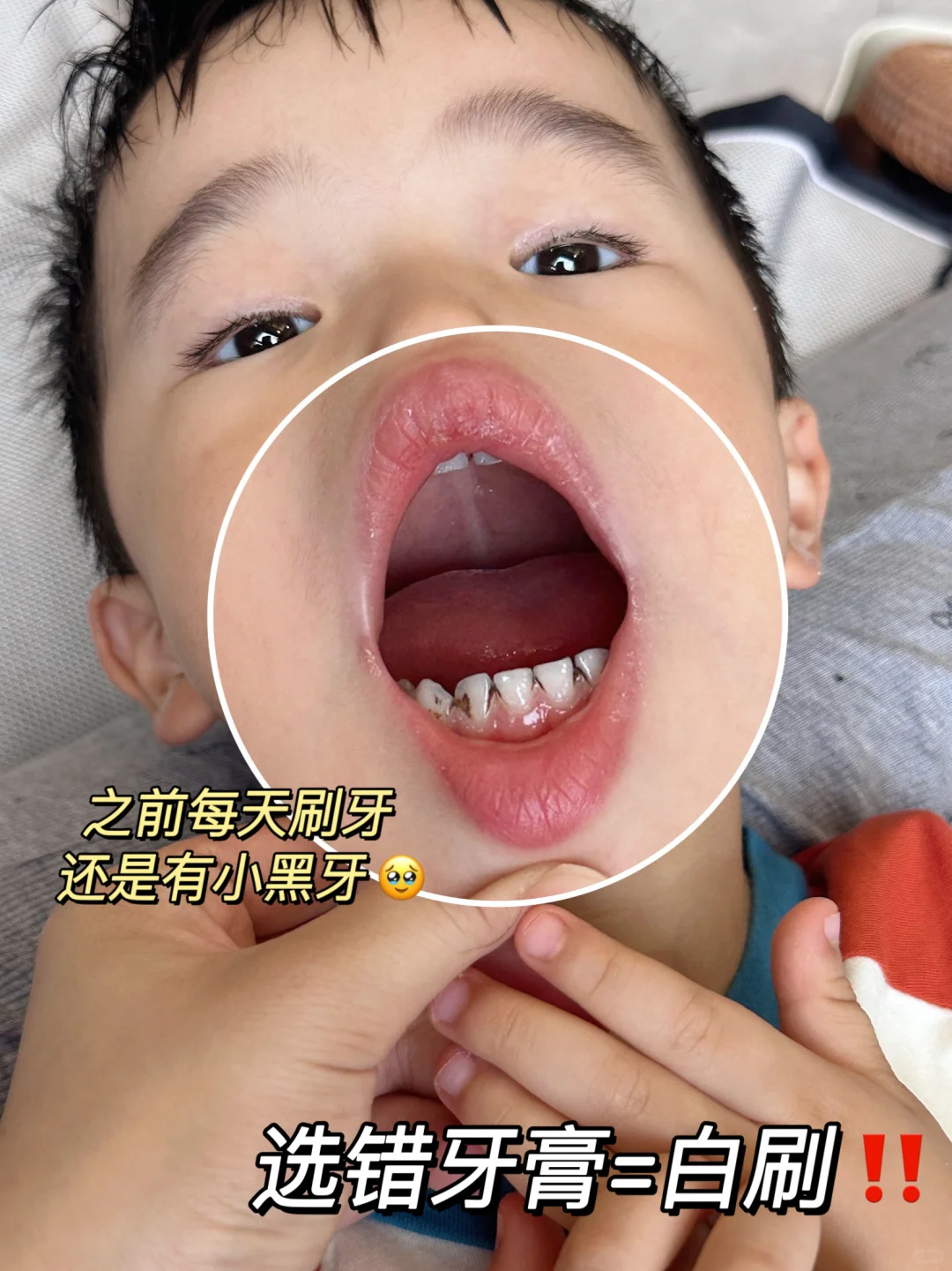 怒推😠防蛀牙我只服它‼️‼️