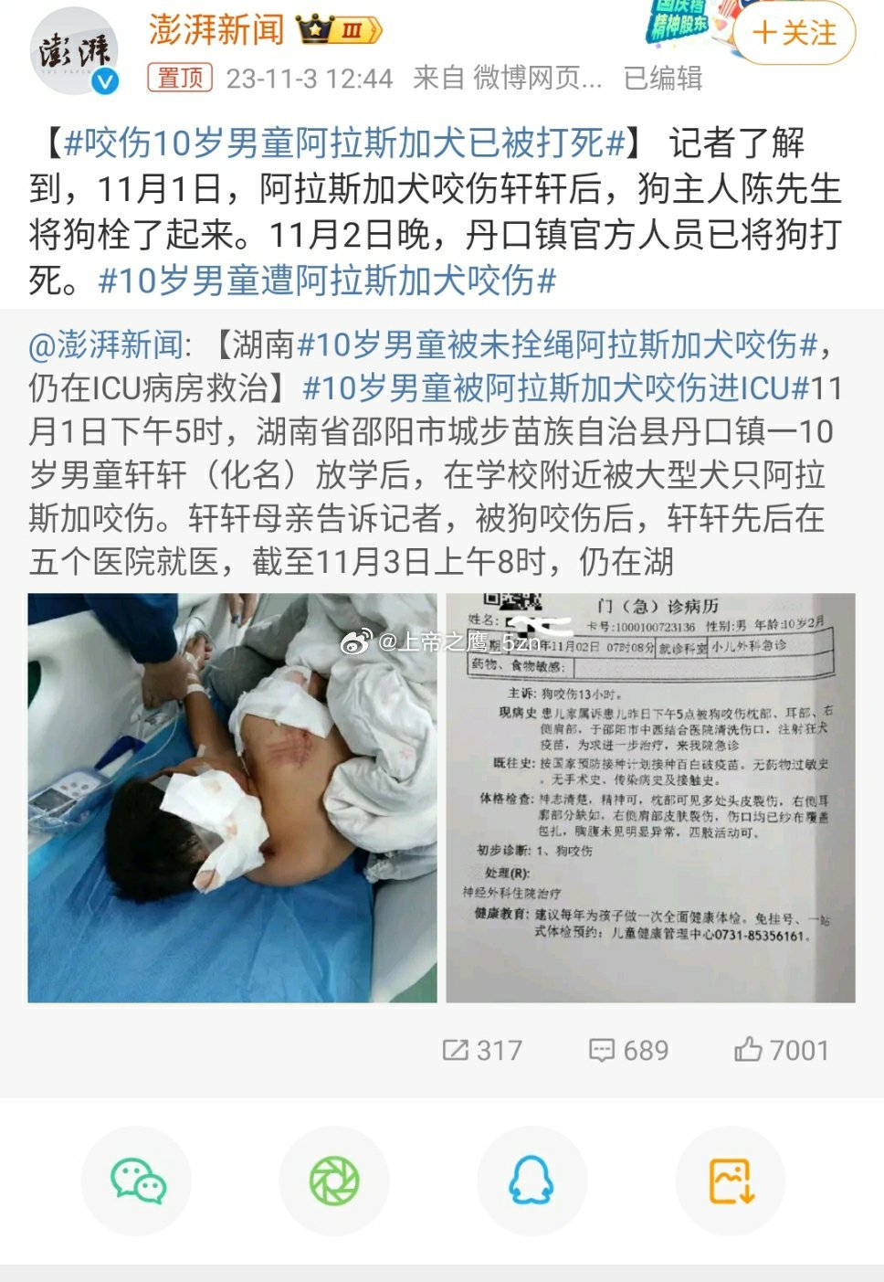 #咬伤10岁男童阿拉斯加犬已被打死#都咬了人了，不打死，等着谁把丫接回家当祖宗供