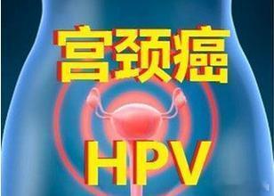 hpv阳性就提示宫颈癌吗让她健康全民慢病健康科普计划 【“HPV感染=私生活混乱