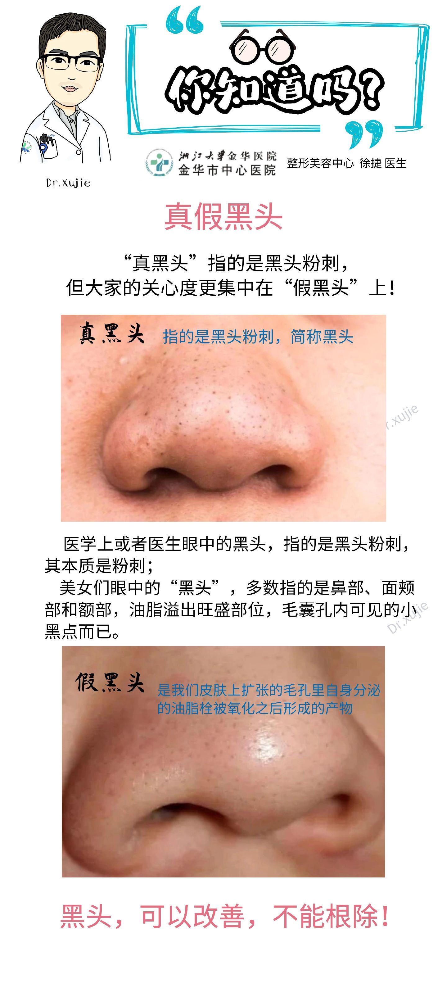 改善毛孔粗大，保姆级攻略。毛孔粗大治疗虽可改善，但无法实现零毛孔，切勿矫枉过正