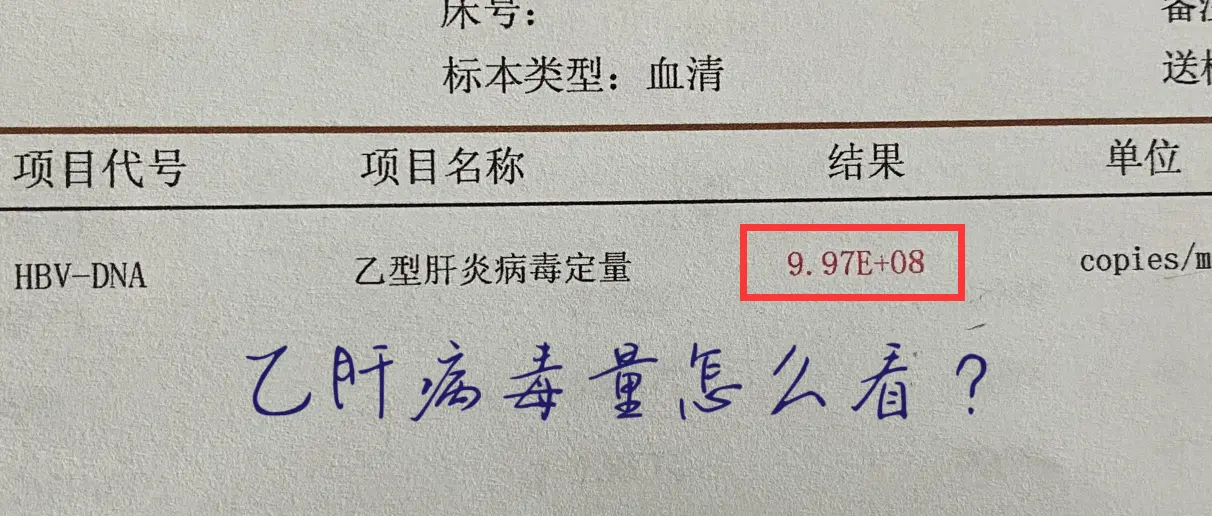 乙肝病毒量应该怎么看？。很多患者拿到病毒检查的单子后，看不太明白病毒是...