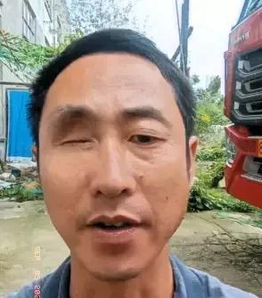 一男子在网上吐槽，他一只眼睛没了，想办个残疾证，好歹给自己讨个说法。结果工作人员