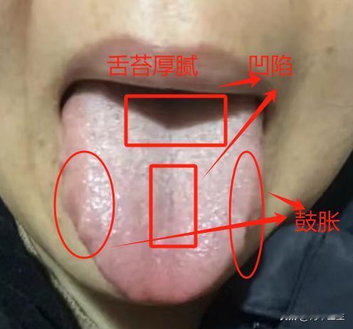 肝气郁滞引起的那个功能下降，别再补肾了没用，疏肝才是重中之重

患者主诉：那个功