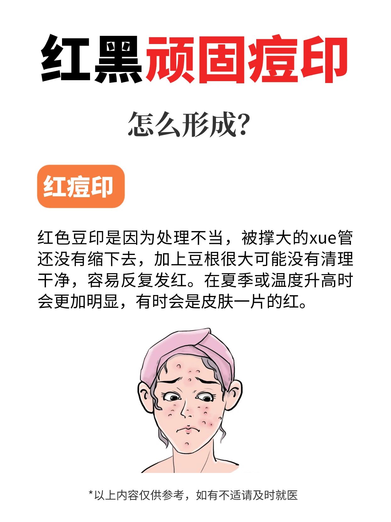 低敏不刺激淡痘印，红黑痘印的仙女查收~