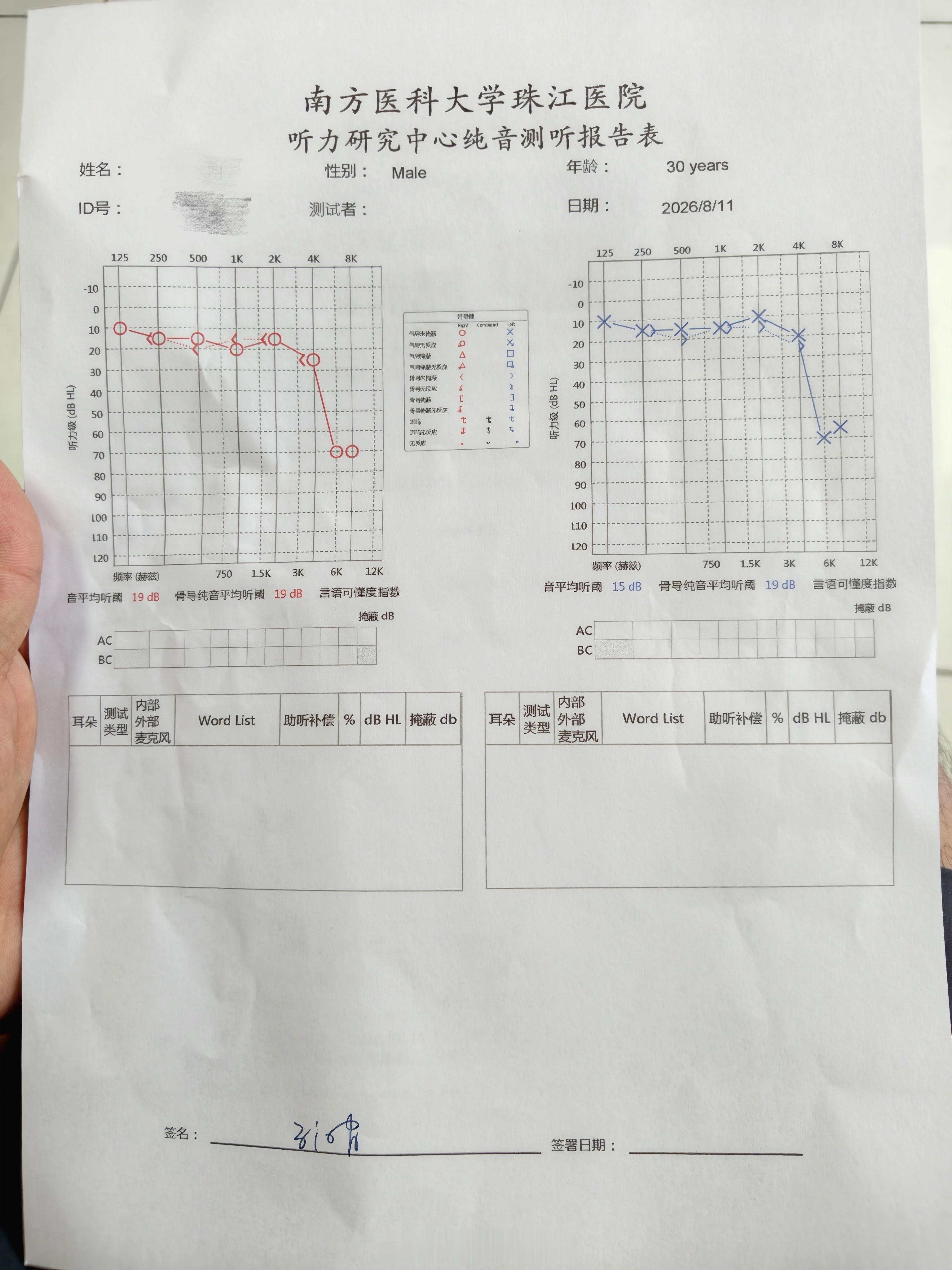 听力检查已经做完了，没什么大问题，就是个小状况，吃点药就好了。之前还担心是不是右